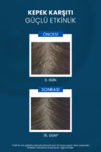 Kelual DS Şampuan İnatçı ve Şiddetli Kepek Şampuan 100 ml - Görsel 3