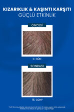 Kelual DS Şampuan İnatçı ve Şiddetli Kepek Şampuan 100 ml - Görsel 4